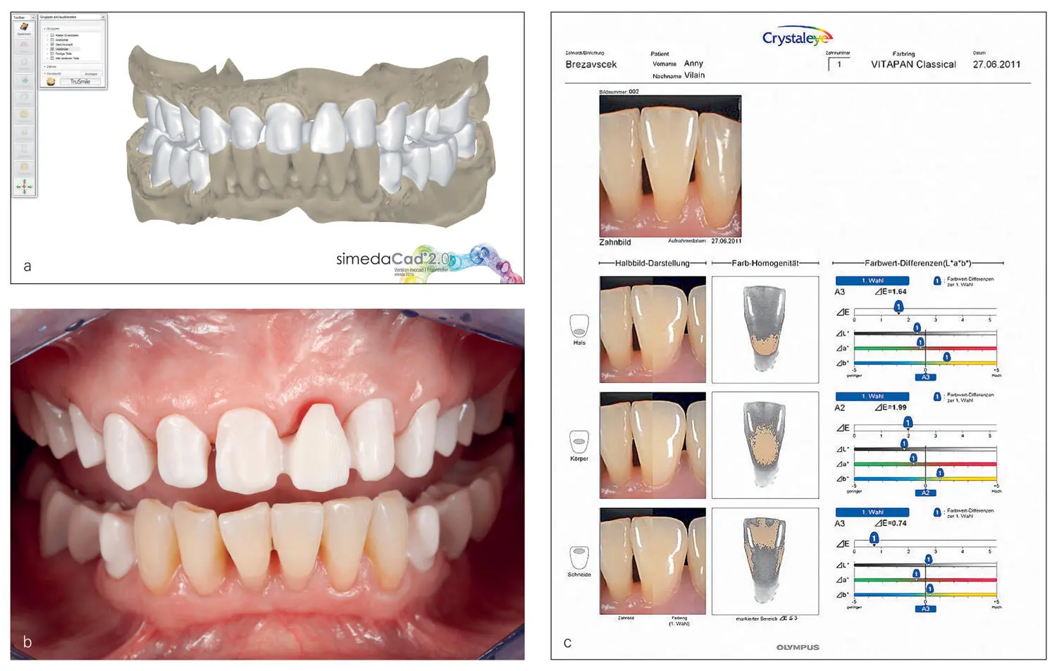 Fig 225By using a digital cutback the framework design was created The - фото 34