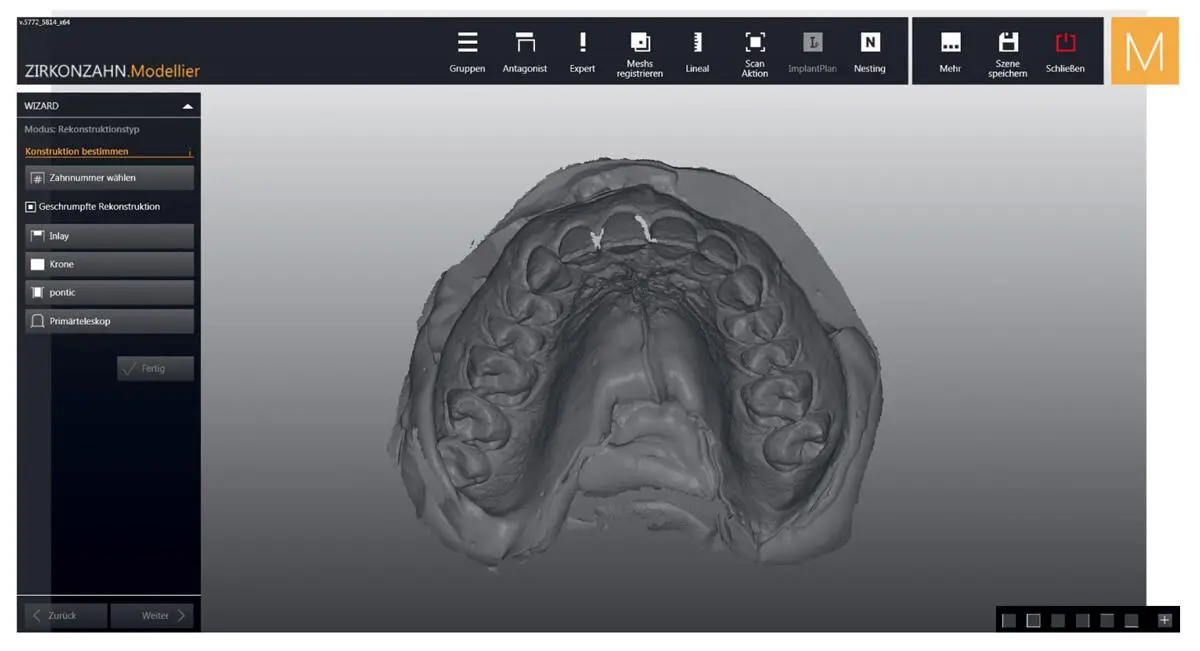Fig 33Image of a scanned dental impression Usually the scanner features at - фото 42