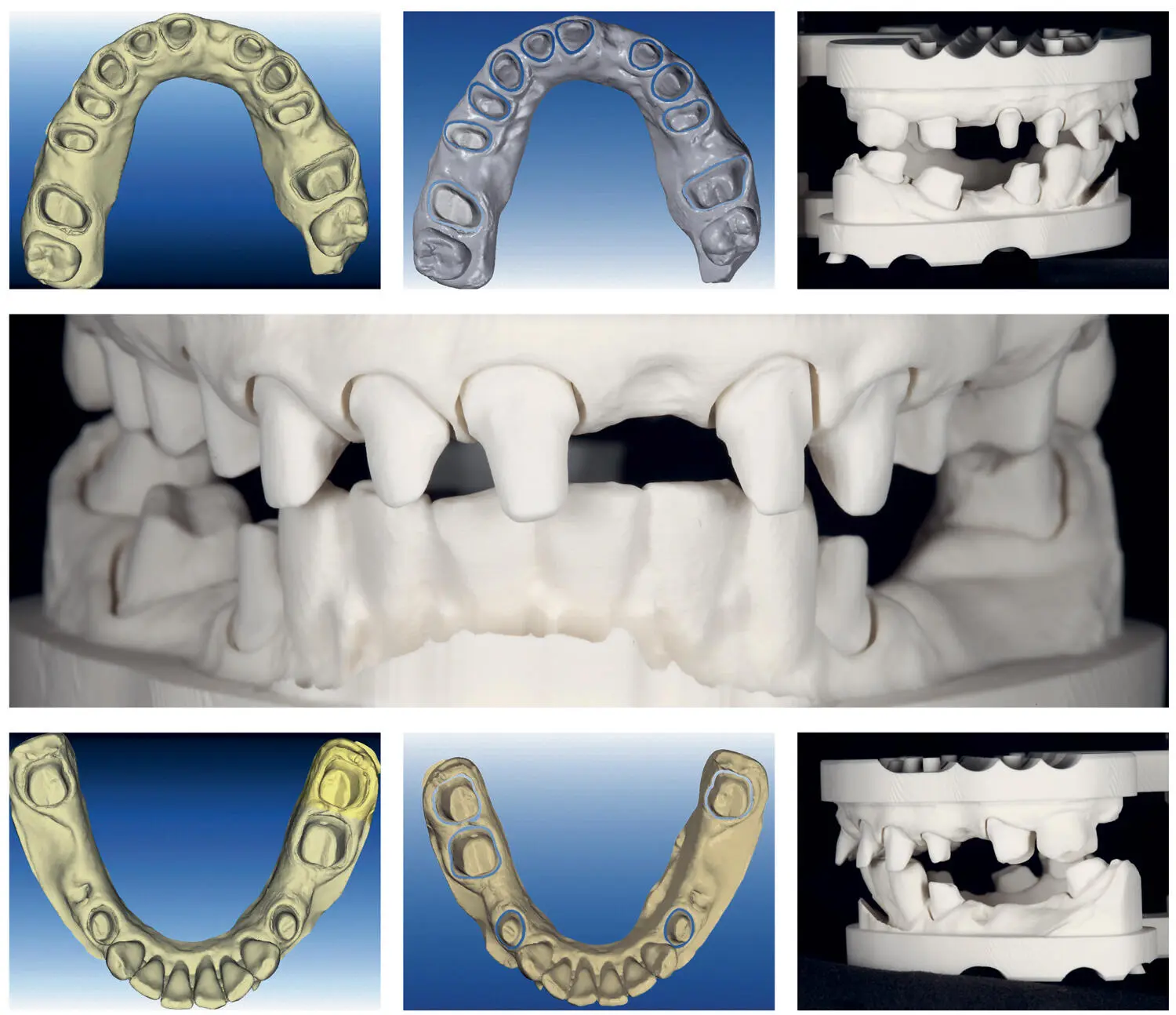 Fig 223Digital images of the scanned maxilla and mandible The optical - фото 32