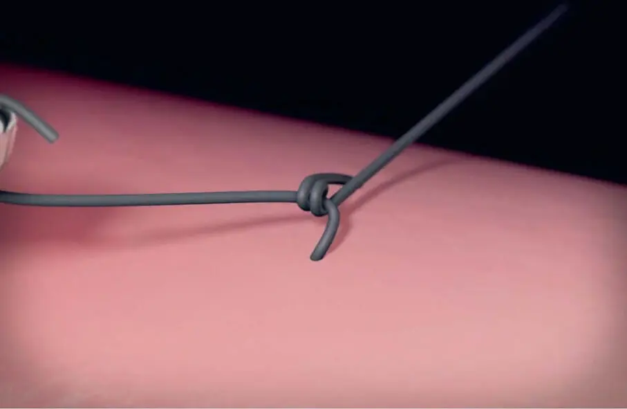 Abb 31Bei multifilem Nahtmaterial ist der erste Knoten ein Doppelknoten aus - фото 87