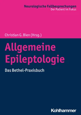 Неизвестный Автор Allgemeine Epileptologie обложка книги