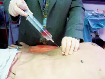 Periocardiocentesis 12 Toracostomía de emergencia Ante pacientes en - фото 50