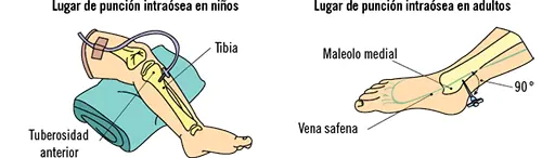 Apoyo al soporte vital avanzado SANT0108 - изображение 18