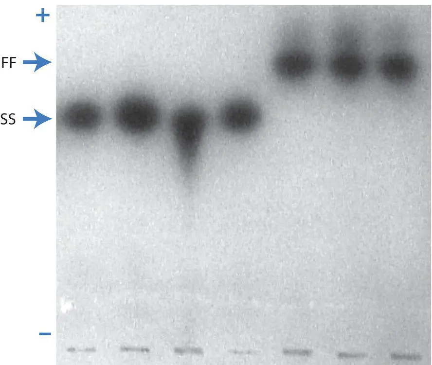 Figure 211 An allozyme gel stained to show alleles at the phosphoglucomutase - фото 64