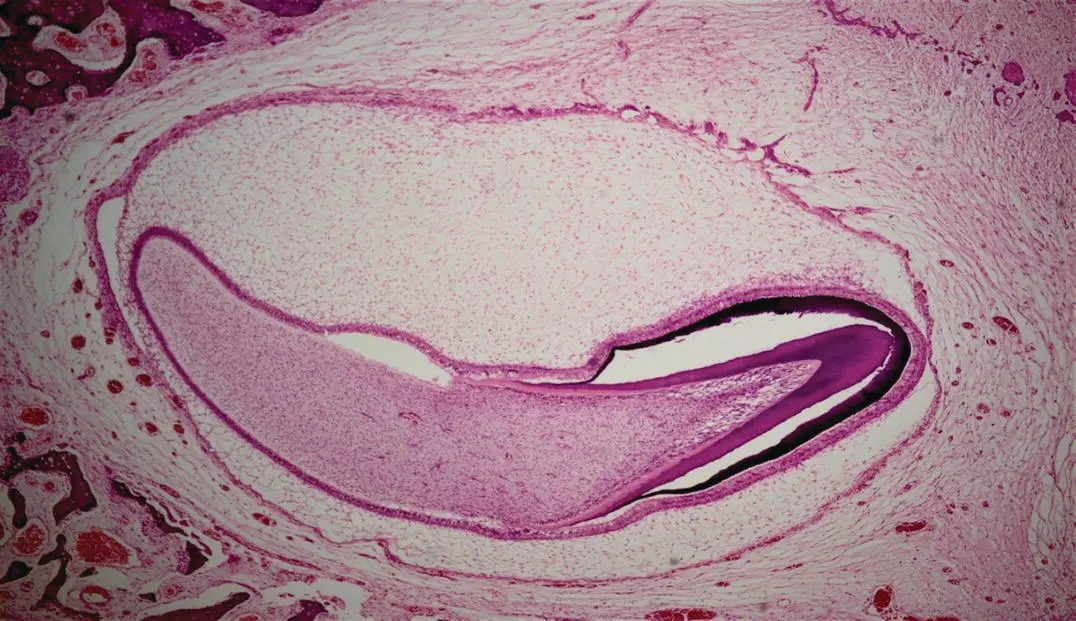 Figure 18H and E stained decalcified section showing the late bell stage of - фото 11