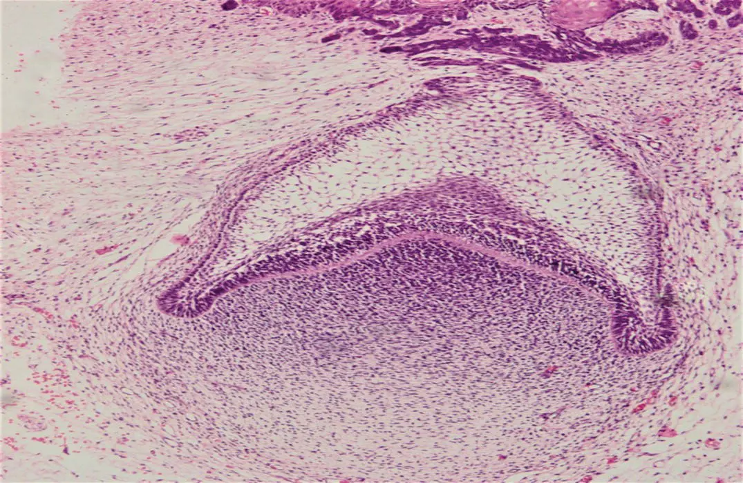 Figure 14H and E stained section showing the cap stage of tooth development - фото 7