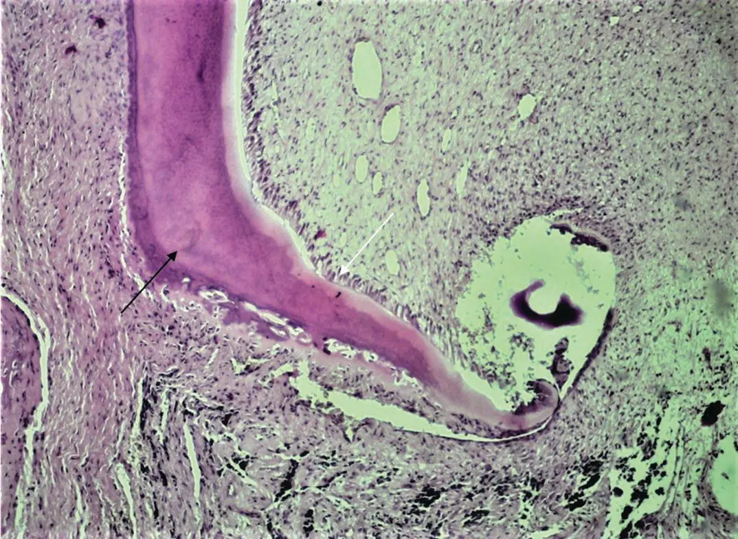 Figure 110H and E stained section showing a tooths root formation white - фото 13
