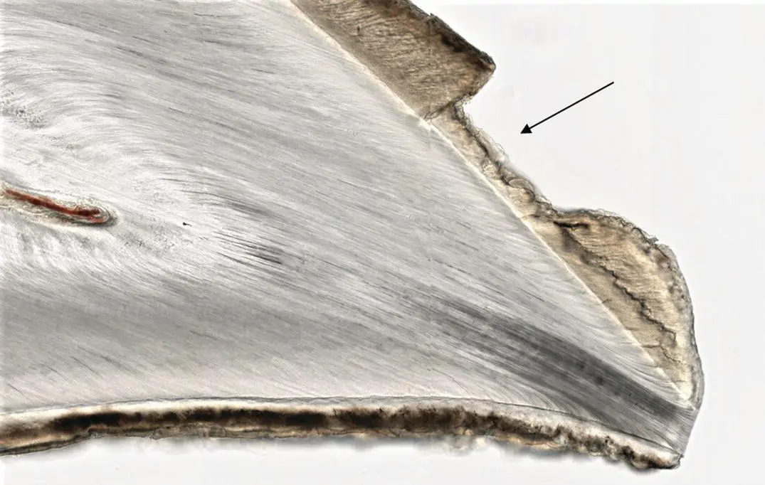 Figure 112Highpower view of a ground section of a deciduous incisor showing - фото 15