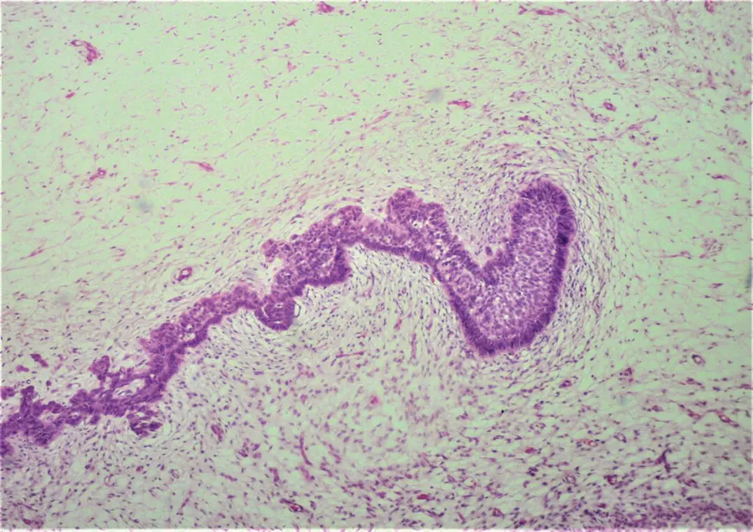 Figure 12H and E stained section showing the bud stage of tooth development - фото 5