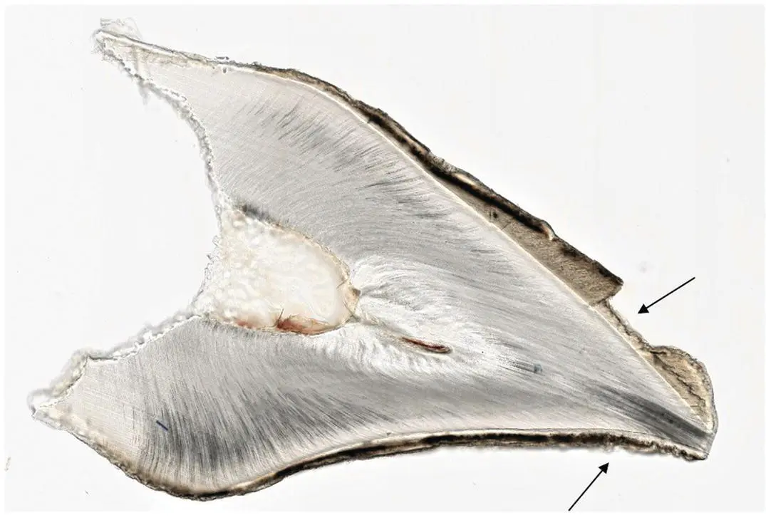 Figure 111Lowpower view of a ground section of a deciduous incisor showing - фото 14