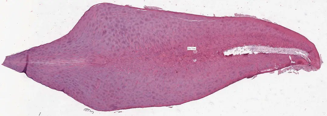 Figure 113H and E stained decalcified section showing DI Figure 114H and E - фото 16