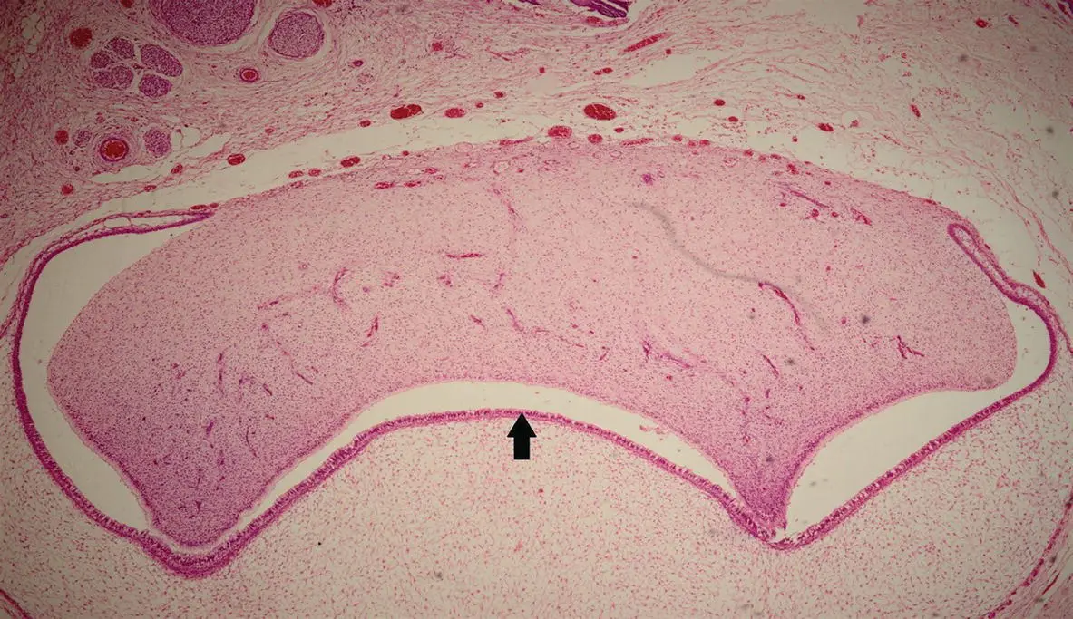 Figure 17H and E stained section showing the early bell stage of tooth - фото 10