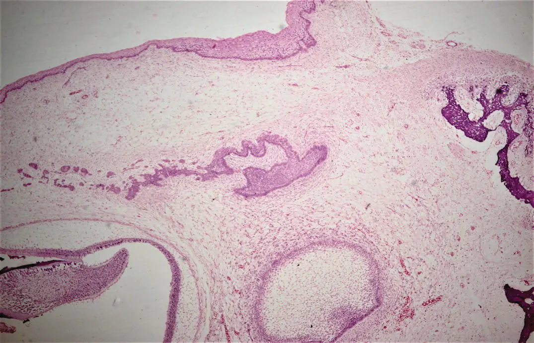 Figure 11H and E stained section showing tooth development Tooth development - фото 4