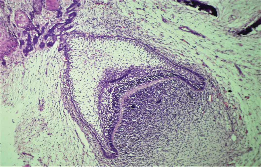 Figure 15H and E stained section showing the cap stage of tooth development - фото 8