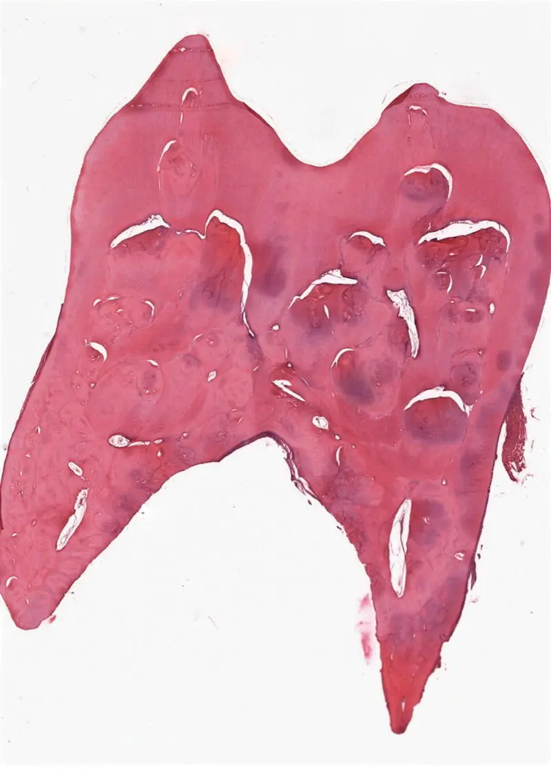 Figure 115H and E stained decalcified section showing DD with haphazard - фото 18