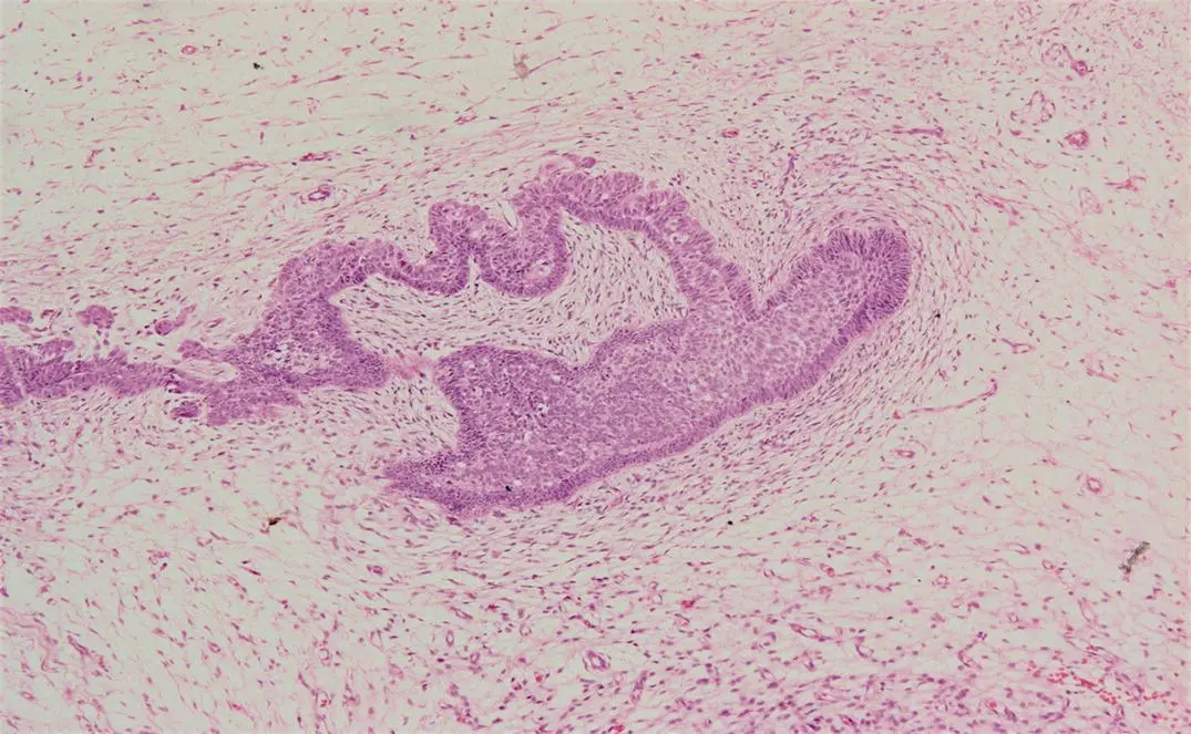 Figure 13H and E stained section showing the bud stage of tooth development - фото 6