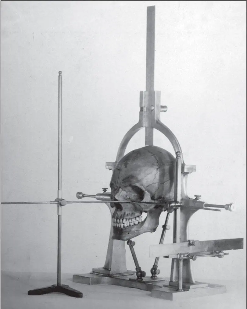 Fig 13An original Broadbent craniostat used to standardize skull position and - фото 5