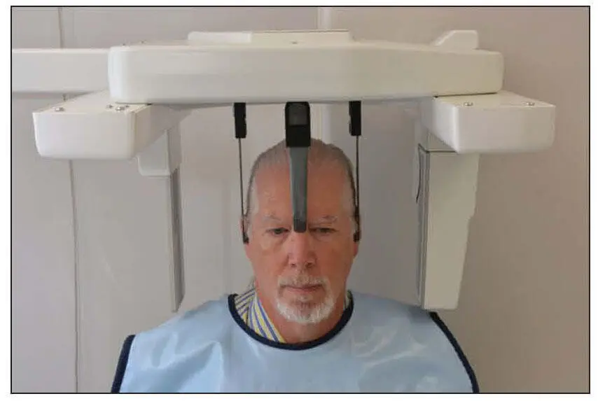 Fig 21Proper patient positioning for a lateral cephalogram showing the - фото 10