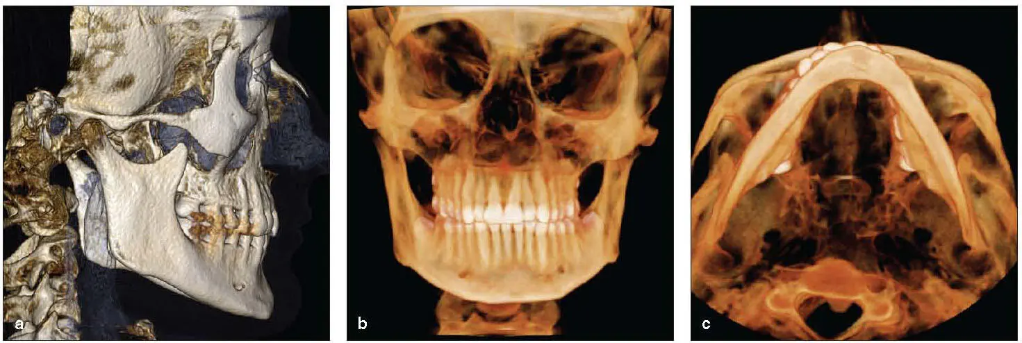 Fig 29Examples of 3D reconstructions a Lateral cephalometric rendering b - фото 18