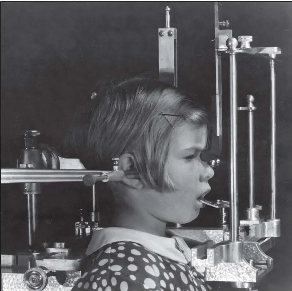 Fig 14An original Broadbent cephalometric craniostat consisting of a - фото 6