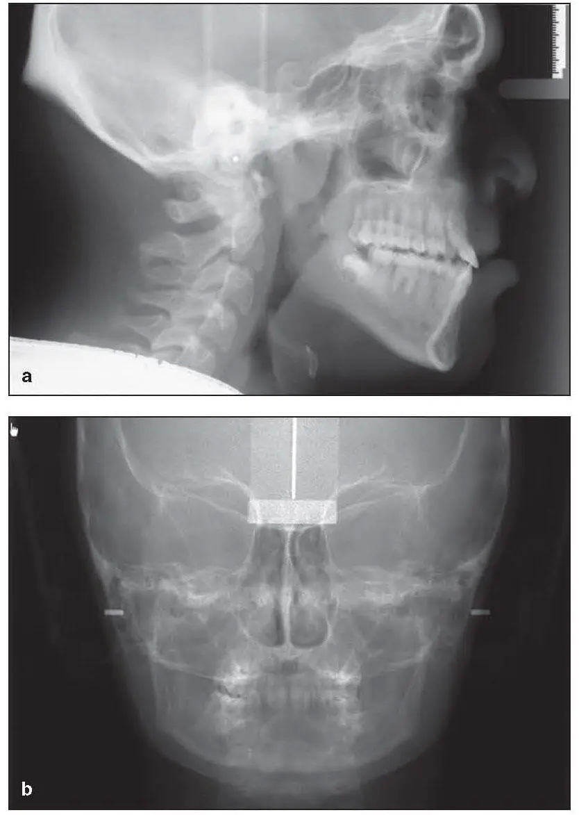 Fig 26Examples of direct digital scanned lateral a and PA b - фото 15