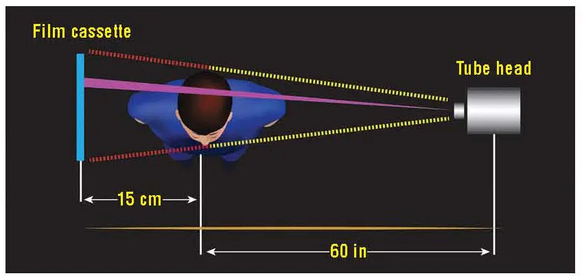 Fig 22Graphic representation of patient positioning for a lateral cephalogram - фото 11