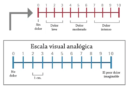 Figura 3 Escala Visual Análoga o Analógica Fuente elaboración propia Para - фото 7