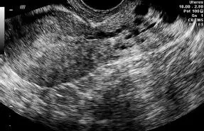 EVALUACIÓN ULTRASONOGRÁFICA DE OVARIOS Y ANEXOS AnexosEl anexo lo - фото 101
