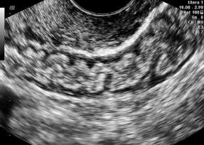 Figura 1679Tabique rectovaginal libre Figura 1680Corte transverso colon - фото 144
