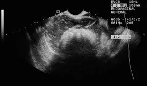 Figura 169Imagen en forma de rayos provocado por aire en intestino y - фото 74