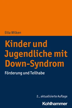 Etta Wilken Kinder und Jugendliche mit Down-Syndrom обложка книги