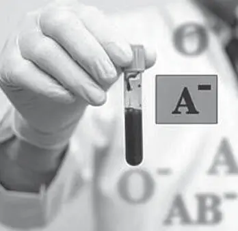 Abb 28 Blutgruppe und 2019nCoV Neben dem Blutgruppensystem AB0 gibt es noch - фото 29