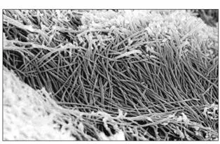 Fig 26bHigher magnification of the wall of the tubule in the predentin No - фото 41