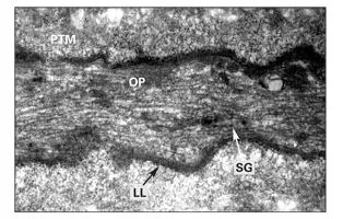 Fig 29Odontoblastic process OP from middle region of the dentin viewed in - фото 44
