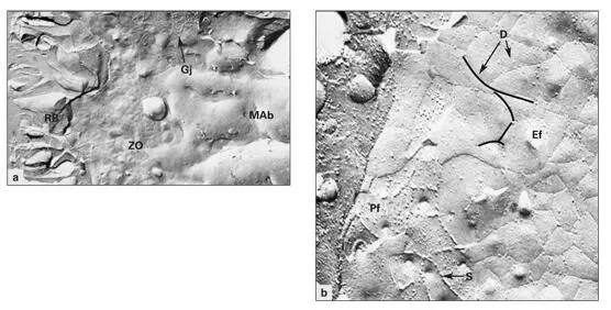 Figs 315a and 315bFreezefracture replica of the distal plasma membrane of a - фото 73