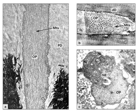 Figs 27a to 27cElectron micrographs of the odontoblastic process OP in - фото 42