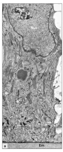Fig 310aDistal part of a ruffleended maturation ameloblast Em Enamel - фото 66