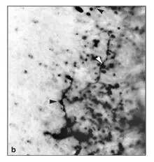 Fig 210bInset area in Fig 210a at higher magnification Nerve terminals are - фото 46