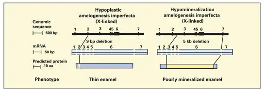 Fig 323Two mutations on the AMEX gene that cause amelogenesis imperfecta - фото 81