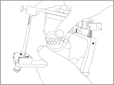 Fig 537The articulator is moved through all excursions Fig 538An anterior - фото 114