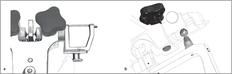 Fig 532The medial wall of the guide is moved a until it contacts the condyle - фото 109