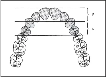Fig 720Secondary retention R must extend a distance from the primary - фото 189