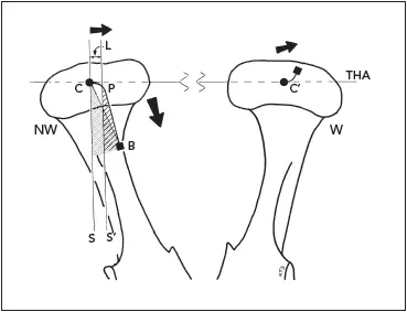Fig 29In the nonworking condyle NW the traditional Bennett angle SCB - фото 27