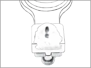 Fig 538An anterior guidance record has been formed in the dovetail incisal - фото 115