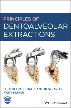 Seth Delpachitra Principles of Dentoalveolar Extractions обложка книги