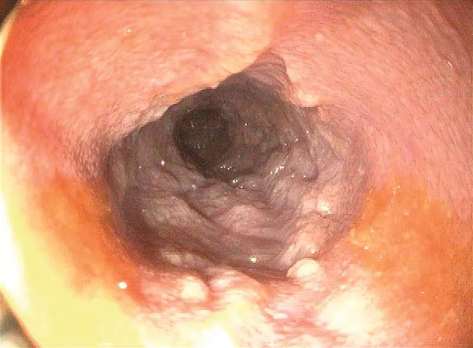 Figure 114 An image of the duodenum in an 8yearold neutered male 10 kg mixed - фото 19
