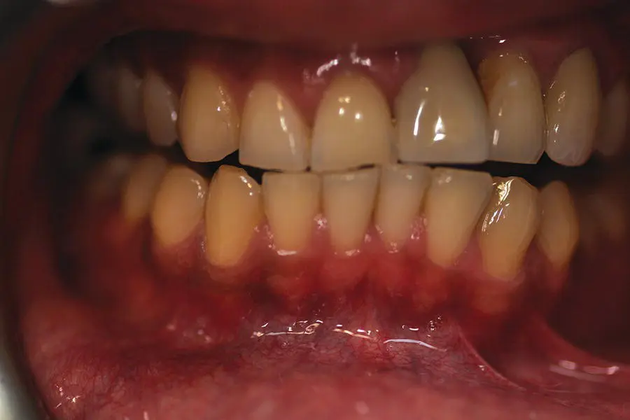 Figure 14 A healthy mouth Asian person Source Alison Chapman ORAL - фото 8