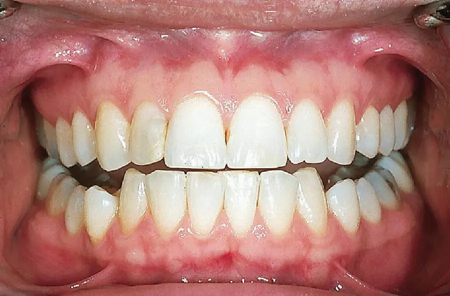 Figure 12 A healthy mouth white person Source 2 Reproduced with - фото 6