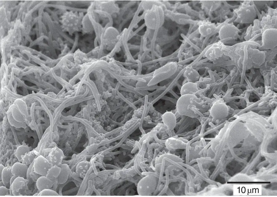 Figure 23 Mature plaque scanning electron microscope Source Dr Rachel - фото 17