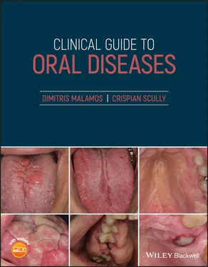 Crispian Scully Clinical Guide to Oral Diseases обложка книги